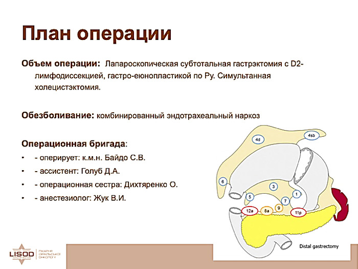 Субтотальная гистерэктомия презентация