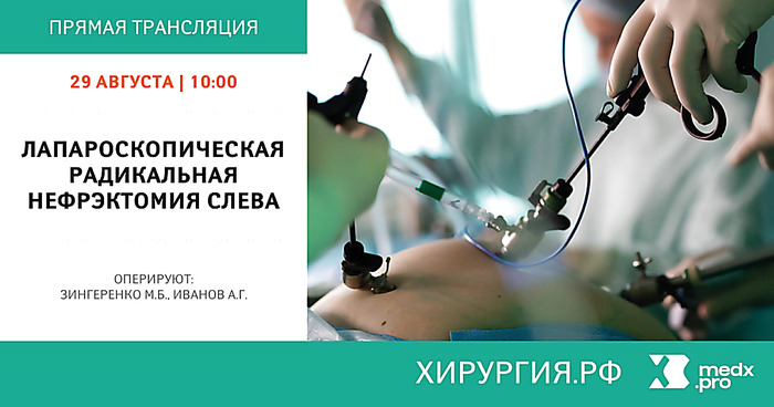 Лапароскопическая радикальная нефрэктомия слева