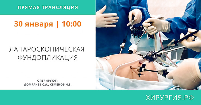 Лапароскопическая фундопликация
