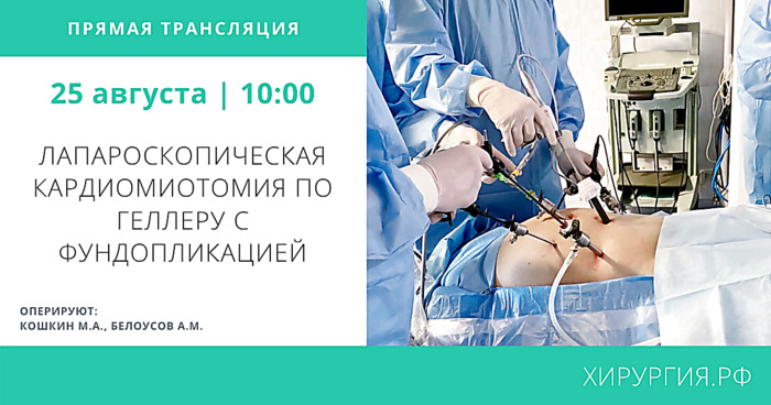 Лапароскопическая кардиомиотомия по Геллеру с фундопликацией